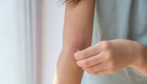 Leia mais sobre o artigo ANVISA torna obrigatório notificar eventos adversos graves com cosméticos