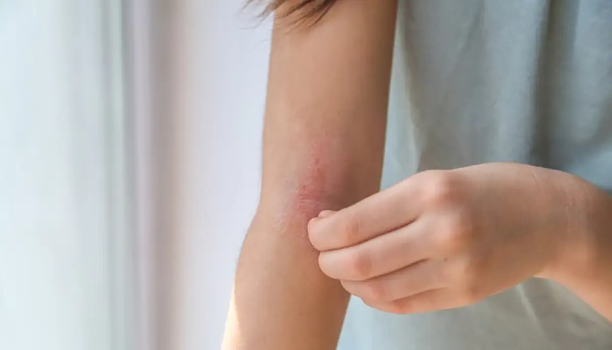 No momento, você está visualizando ANVISA torna obrigatório notificar eventos adversos graves com cosméticos