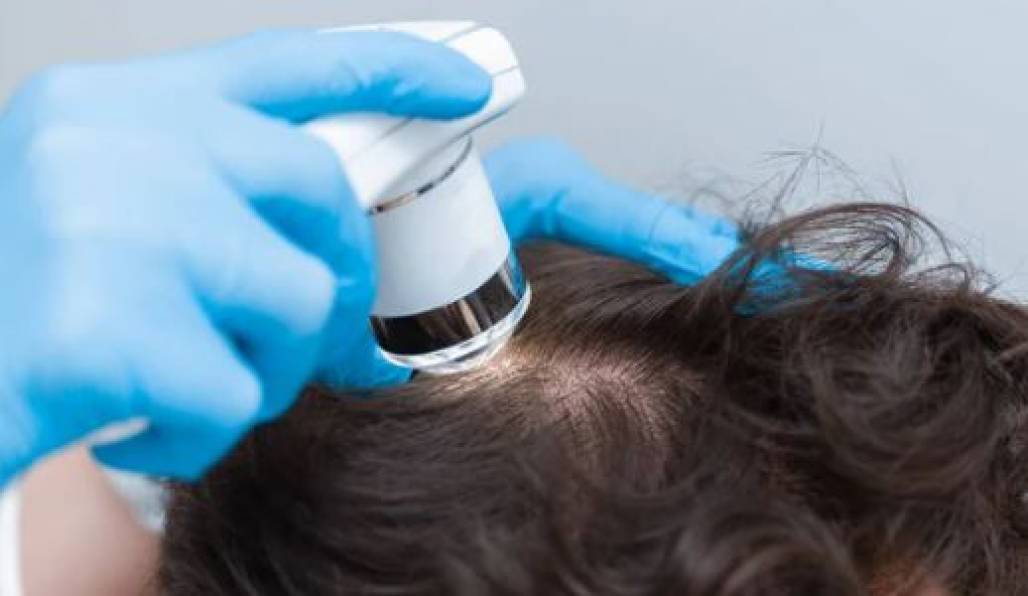 Leia mais sobre o artigo Scalp Care – As tendências desse mercado promissor